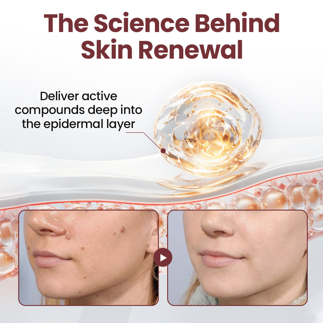 BBOJI®KeraErase Dual-Action Renewal Cream