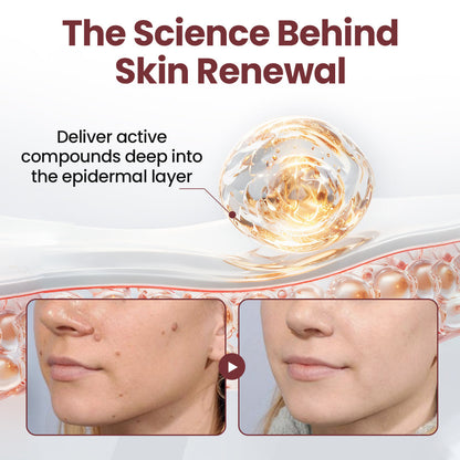 BBOJI®KeraErase Dual-Action Renewal Cream