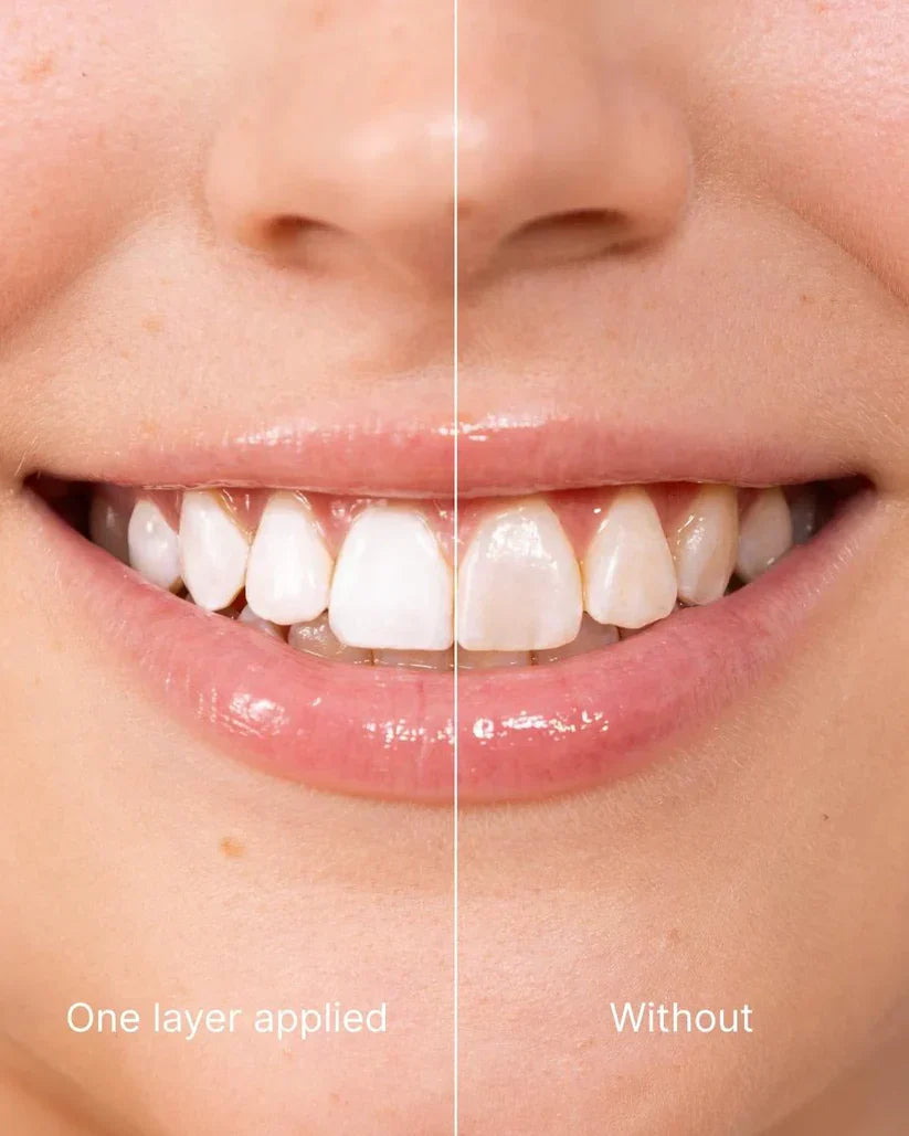 TAILEDEN™ Tooth Polish - Instant Clean Smile