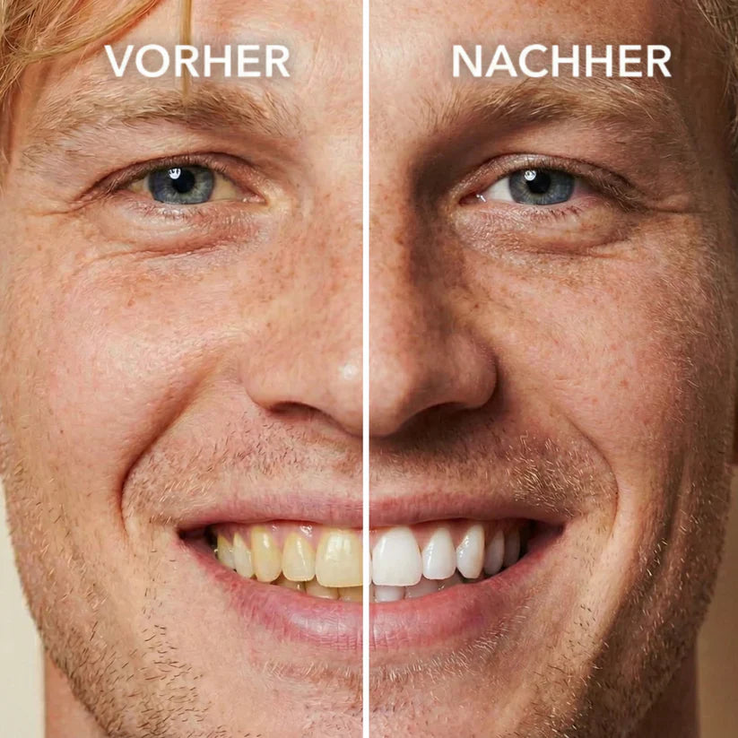 TAILEDEN™ Tooth Polish - Instant Clean Smile