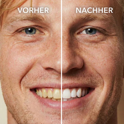 TAILEDEN™ Tooth Polish - Instant Clean Smile
