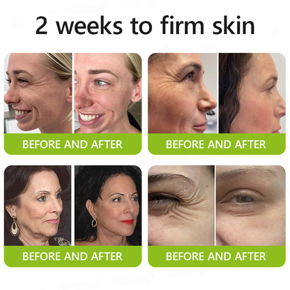 𝑶𝒇𝒇𝒊𝒄𝒊𝒂𝒍 𝑺𝒕𝒐𝒓𝒆👍| Regain youthful skin nown 💫LOVILDS® BOTOX & VITA A RETINOL SHOT Wrinkle Lift Tightening Cream