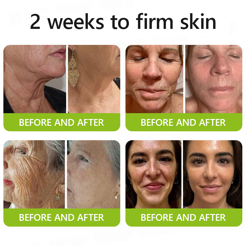 𝑶𝒇𝒇𝒊𝒄𝒊𝒂𝒍 𝑺𝒕𝒐𝒓𝒆👍| Regain youthful skin nown 💫LOVILDS® BOTOX & VITA A RETINOL SHOT Wrinkle Lift Tightening Cream